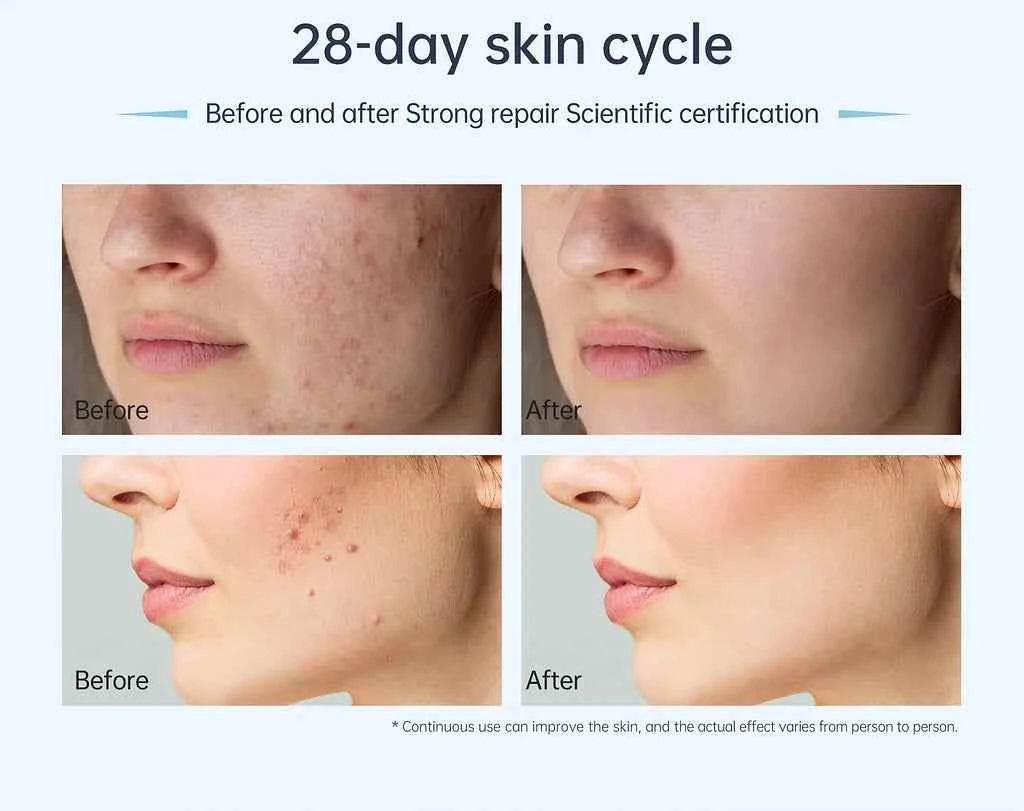 Dr. Pen A11 : Profi-Microneedling Pen