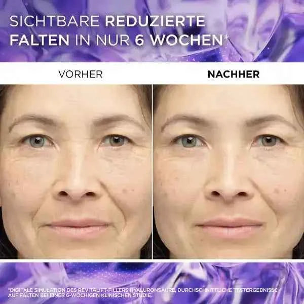 L’Oréal Paris Revitalift Filler [+Hyaluronsäure] Aufpolsterndes Serum