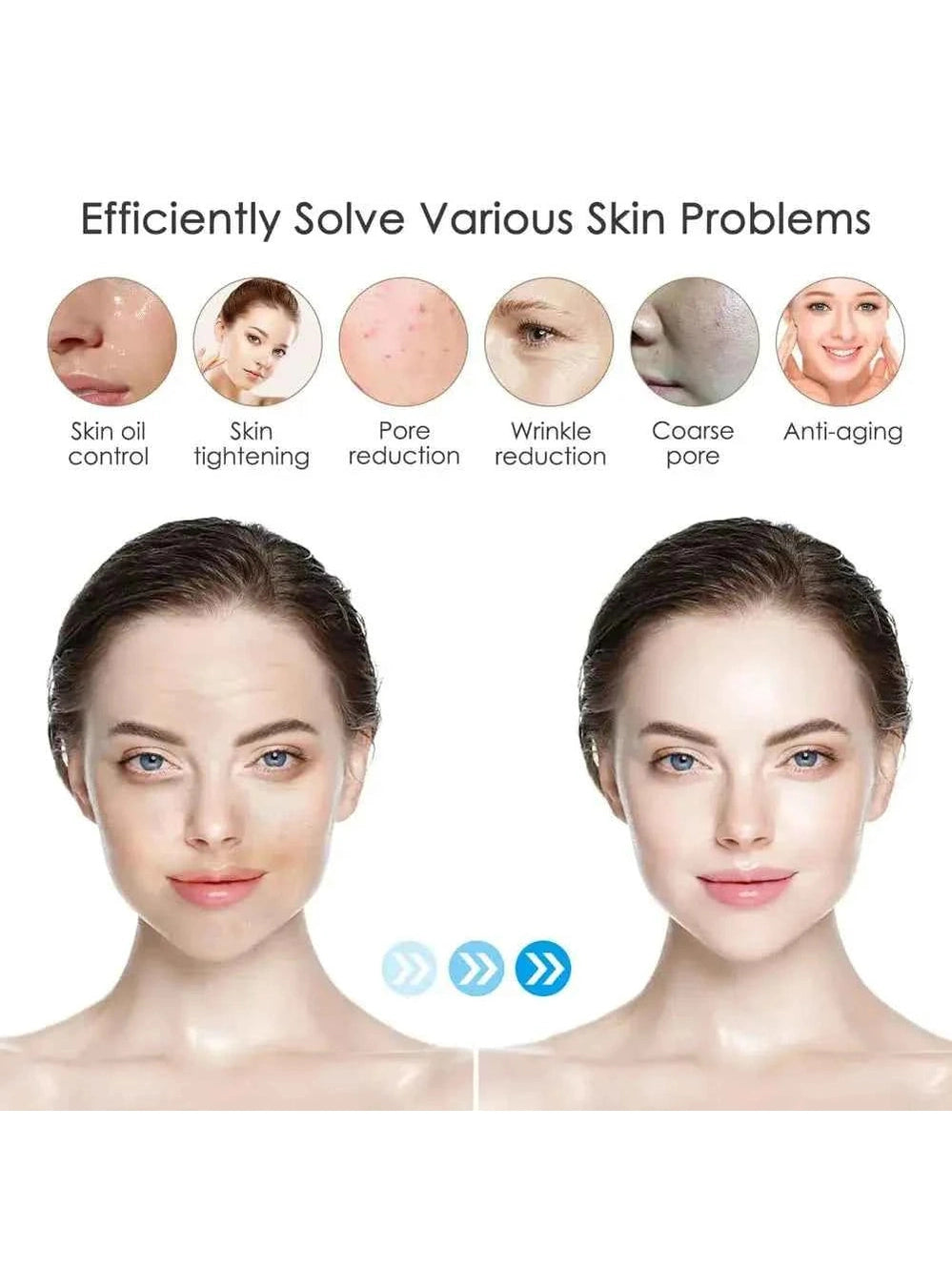Dr. Pen M8 Microneedling Pen mit Kartuschen - Professionelles Microneedling für zu Hause - Ultima M8 Kit